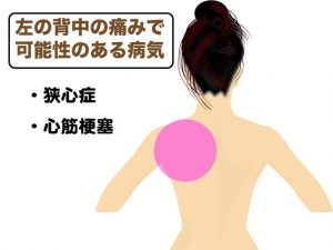 痛い 左肩 が 急な左肩の痛みは狭心症の予兆かも？ 知っておきたい、実は危険な病気の意外な予兆