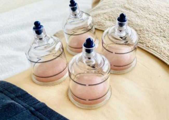 カッピング療法(吸玉)